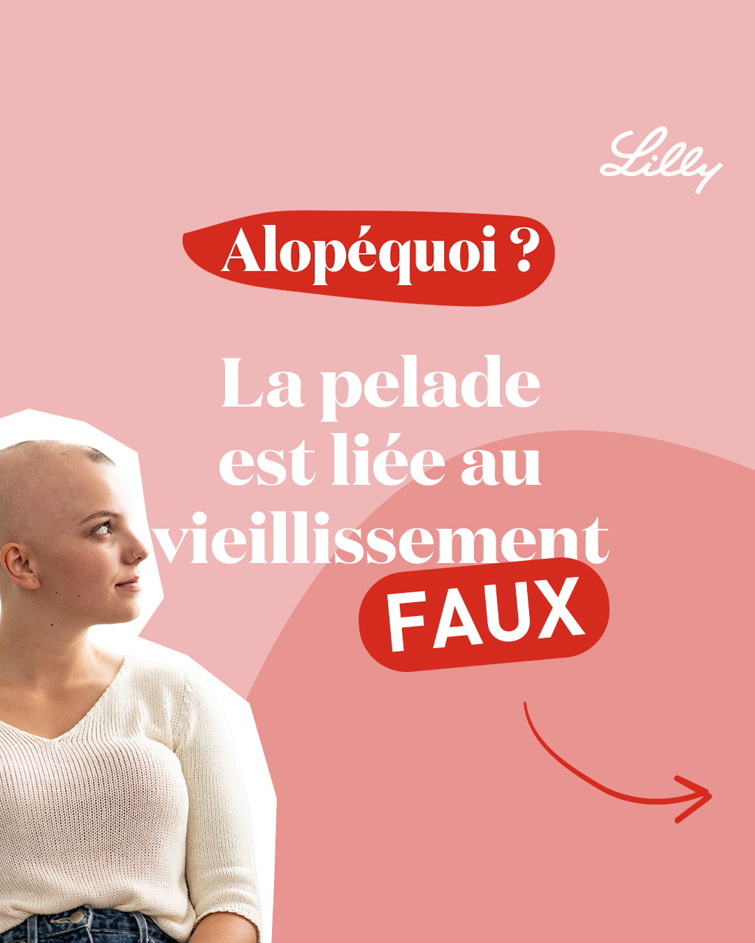 post insta Alopéquoi Vrai Faux