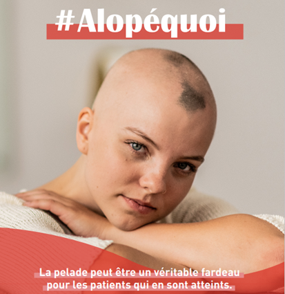 visuel de la campagne Alopéquoi de Lilly France